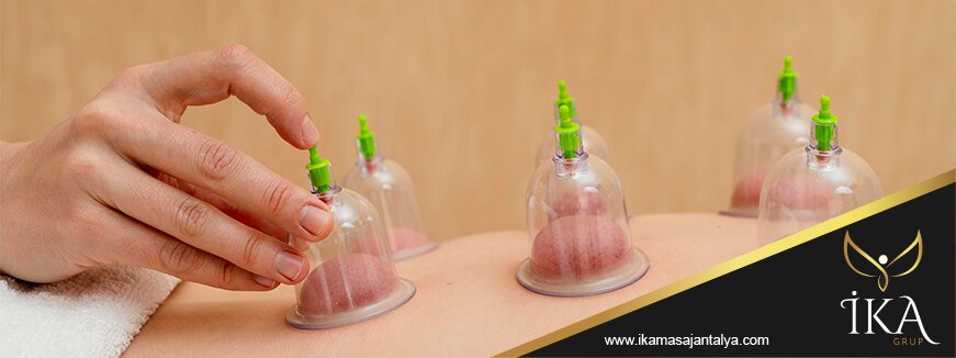 Cupping Masajı Antalya